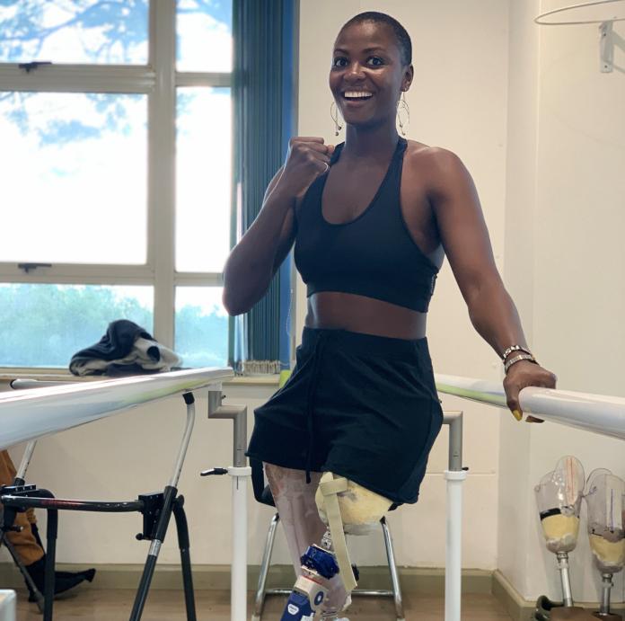 A female athlete pumping her right fist, while standing on two prosthetic legs.