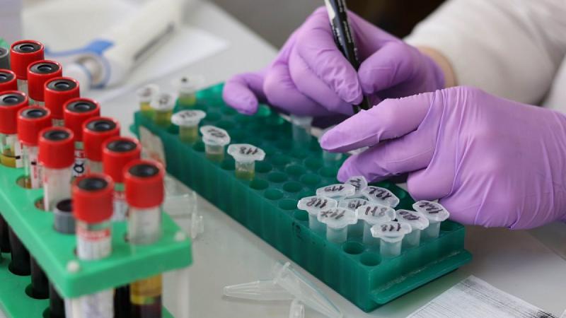 The image of a hand of person manipulating samples in a laboratory