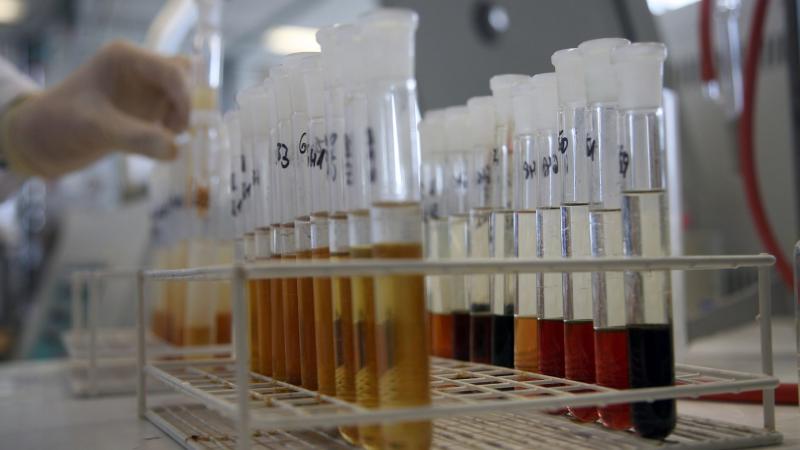 Urine samples on an doping control laboratory
