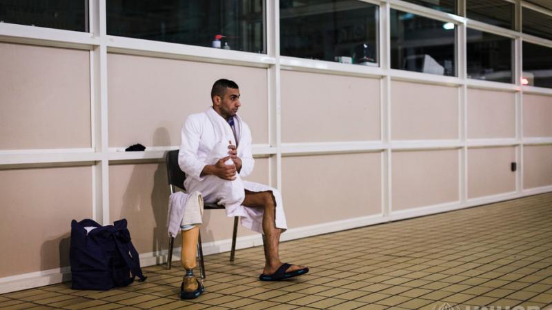 Man with amputated leg sitting close to swimming pool