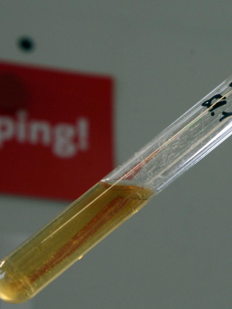 A test tube with a urine sample with a sign that says; "Doping!," behind it