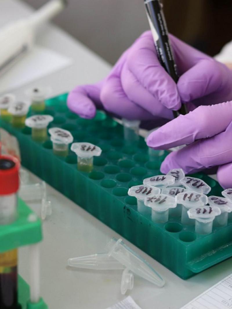 The image of a hand of person manipulating samples in a laboratory