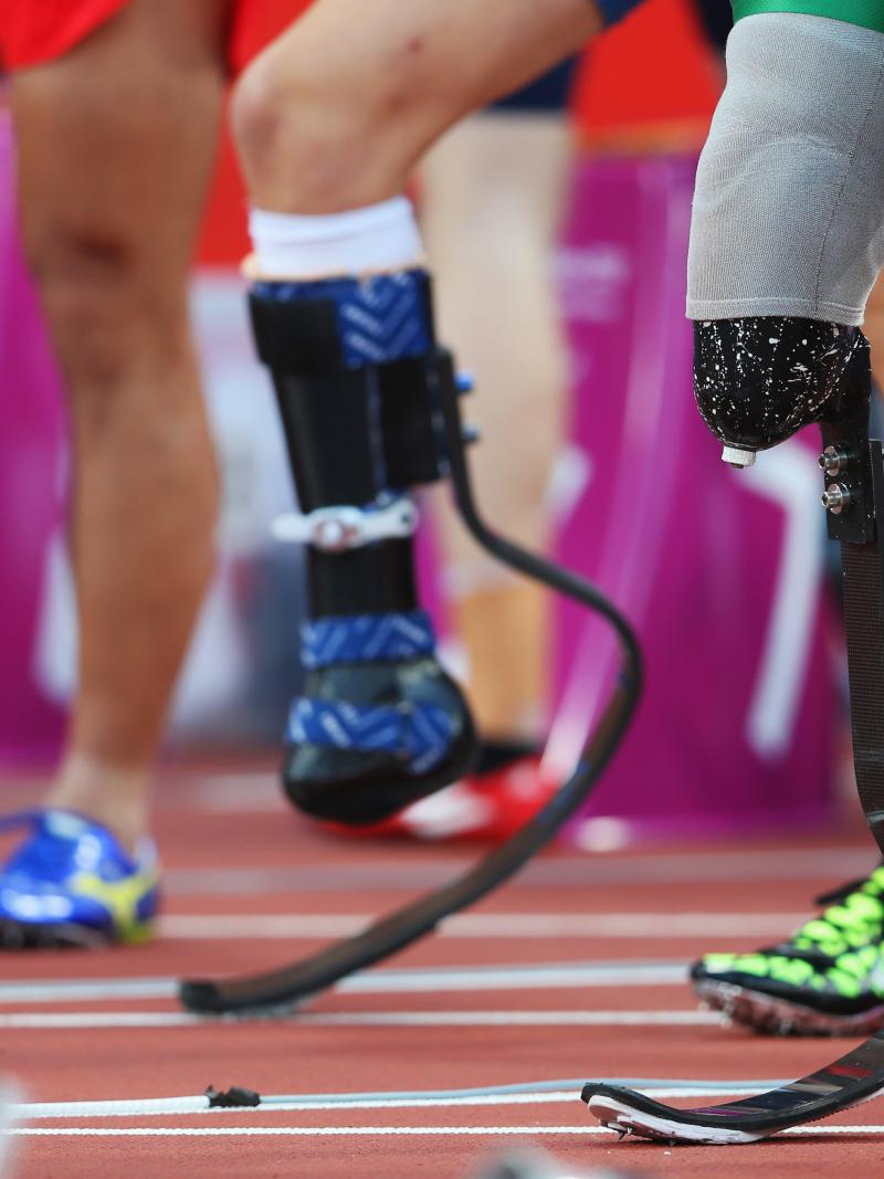 A pictures of prosthetics legs