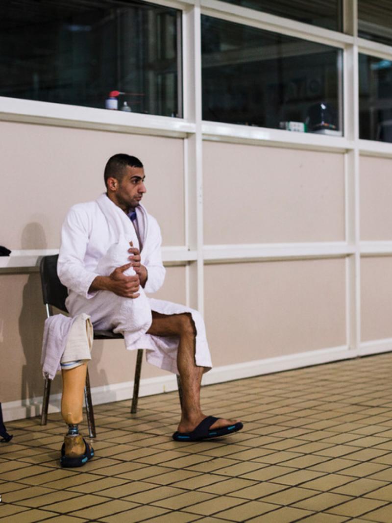 Man with amputated leg sitting close to swimming pool
