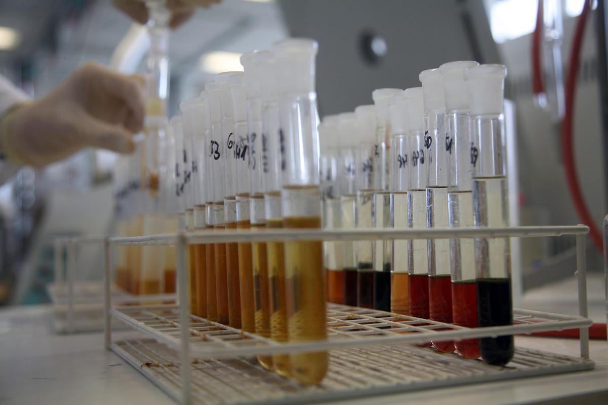 Urine samples on an doping control laboratory