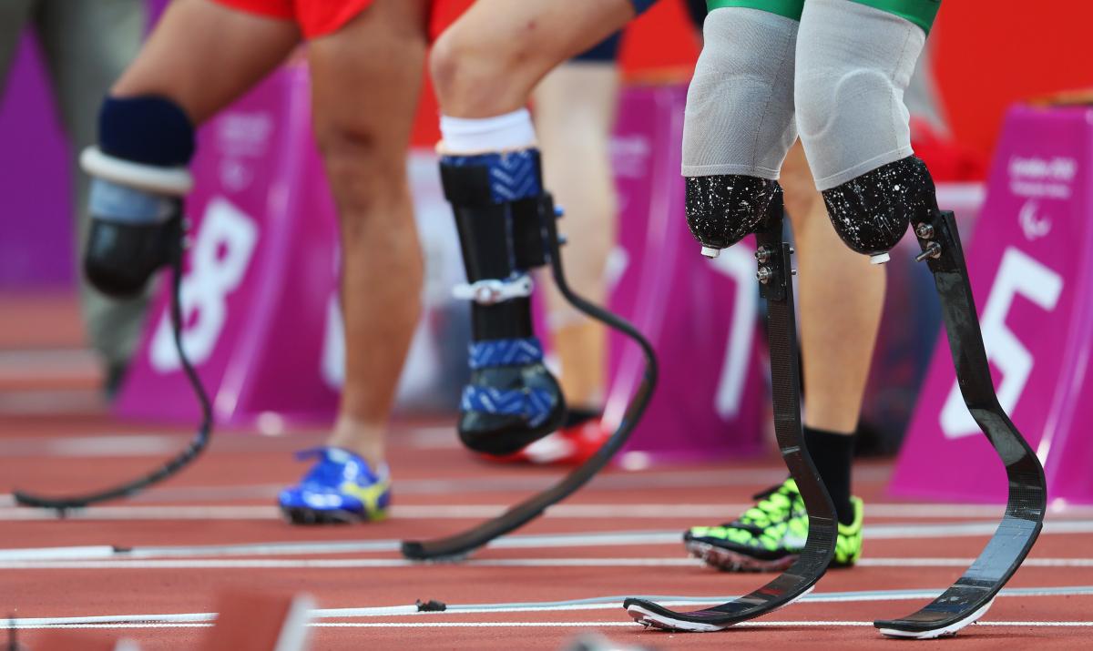 Alan Fonteles Cardoso Oliveira A pictures of prosthetics legs